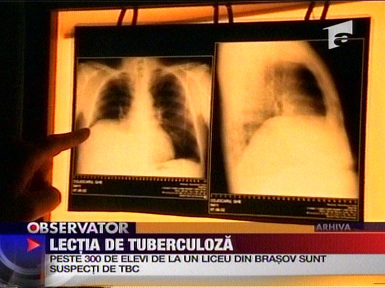 Braşov. Zeci de liceeni ar putea fi bolnavi de tuberculoză, din cauza unui profesor