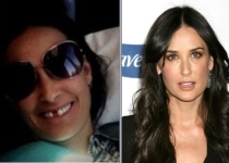 Demi Moore, fără un dinte, pe Twitter. Actriţa a postat poze de la stomatolog (FOTO)