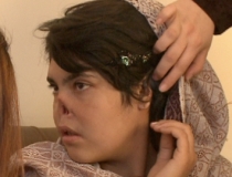 O fată din Afganistan a rămas fără nas şi urechi pentru că a fugit de la familia care o maltrata (FOTO)