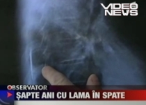 Un bărbat din Hunedoara trăieşte de şapte ani cu o lamă în spate (VIDEO)