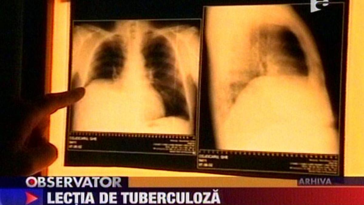 Braşov. Zeci de liceeni ar putea fi bolnavi de tuberculoză, din cauza unui profesor 