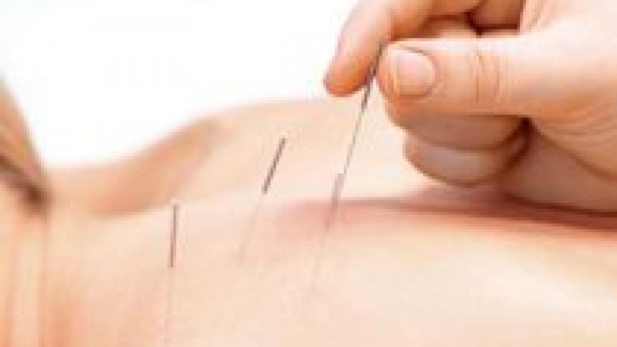 Studiu: Acupunctura nu este eficientă în reducerea durerilor