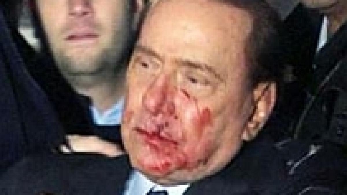 Silvio Berlusconi, lovit în faţă la o manifestaţie de la Milano