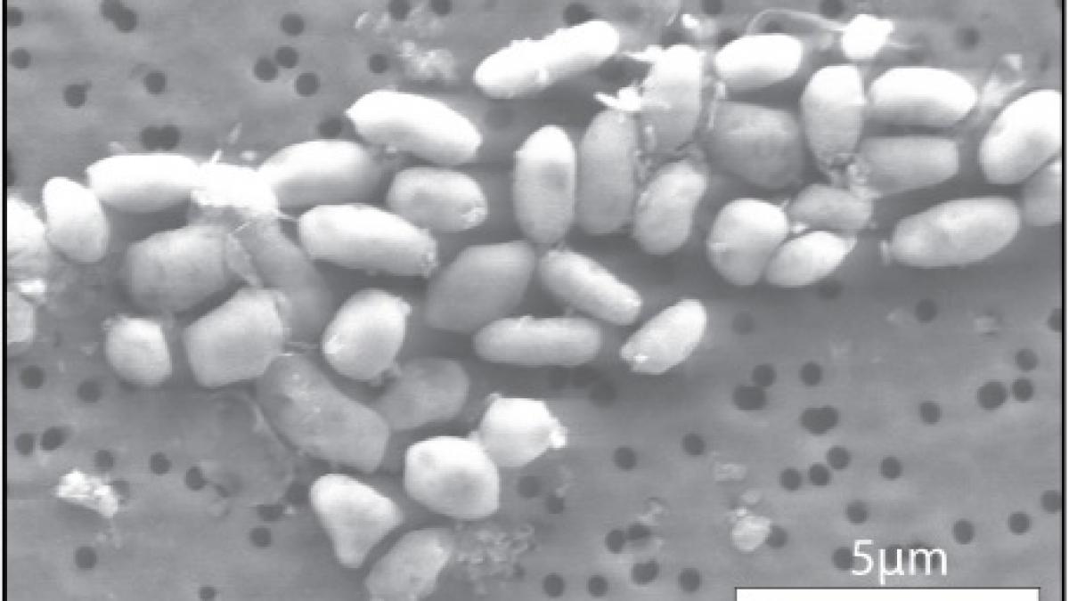 NASA anunţă existenţa unei bacterii care se hrăneşte cu arsenic: Va ajuta la descoperirea altor forme de viaţă