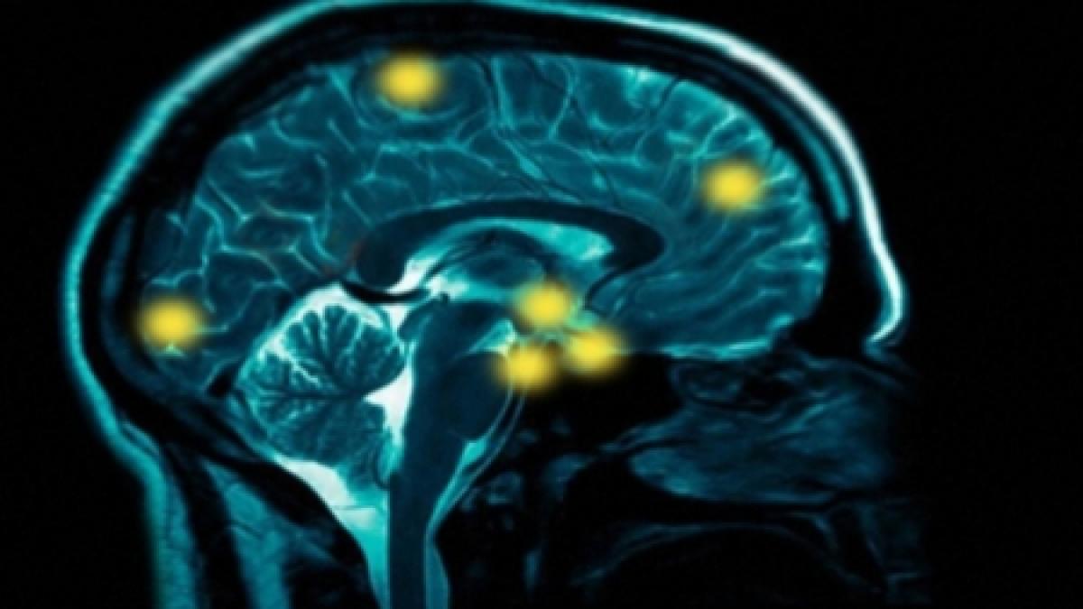 O importantă descoperire ar putea ajuta la tratarea a 130 de afecţiuni, inclusiv Alzheimer