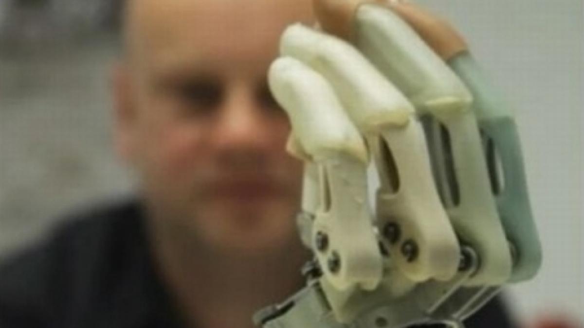 Un student din Iaşi a construit o mână bionică. Dispozitivul ajută şi la operaţii chirurgicale