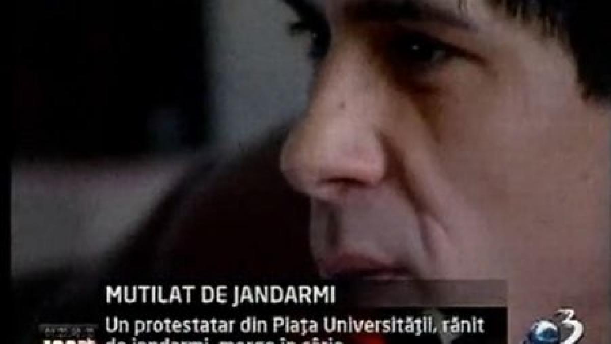 Povestea TRAGICĂ a unui protestatar mutilat de jandarmii din Piaţa Universităţii. Vezi imagini şocante