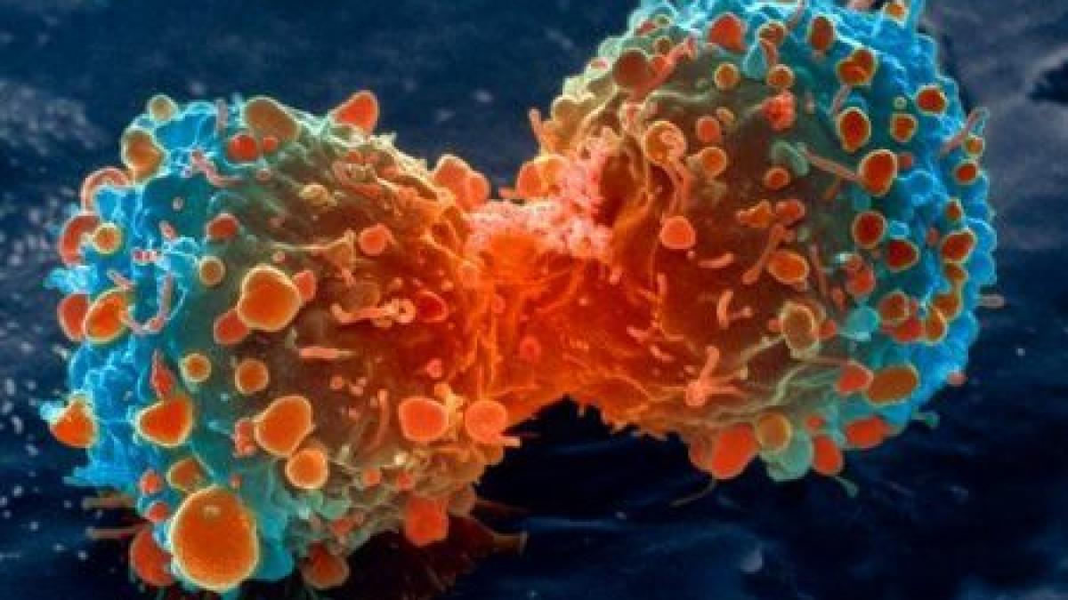 Descoperire revoluţionară în tratamentul cancerului. Molecula distruge numai celulele canceroase