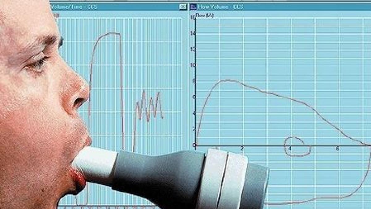 Românii îşi pot verifica GRATUIT starea de sănătate a plămânilor pe 17 şi 18 noiembrie