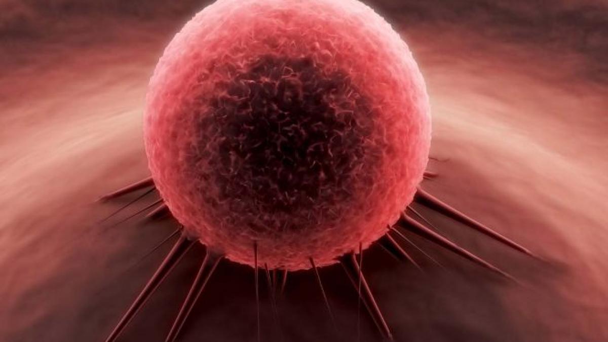 În această zonă a lumii, cancerul ar putea căpăta proporţii EPIDEMICE. Peste 1,7 milioane de cazuri vor fi diagnosticate până în 2030