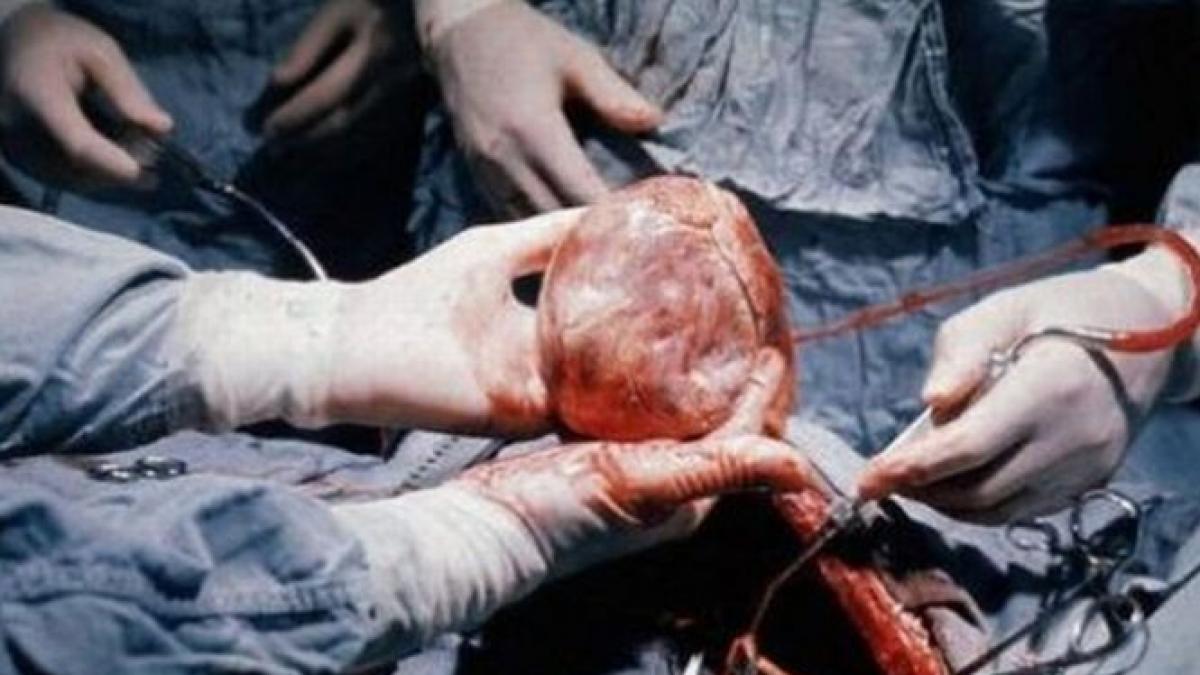 România, performanţă în transplant. Programul de la Fundeni s-a dezvoltat fără precedent în ultimul an