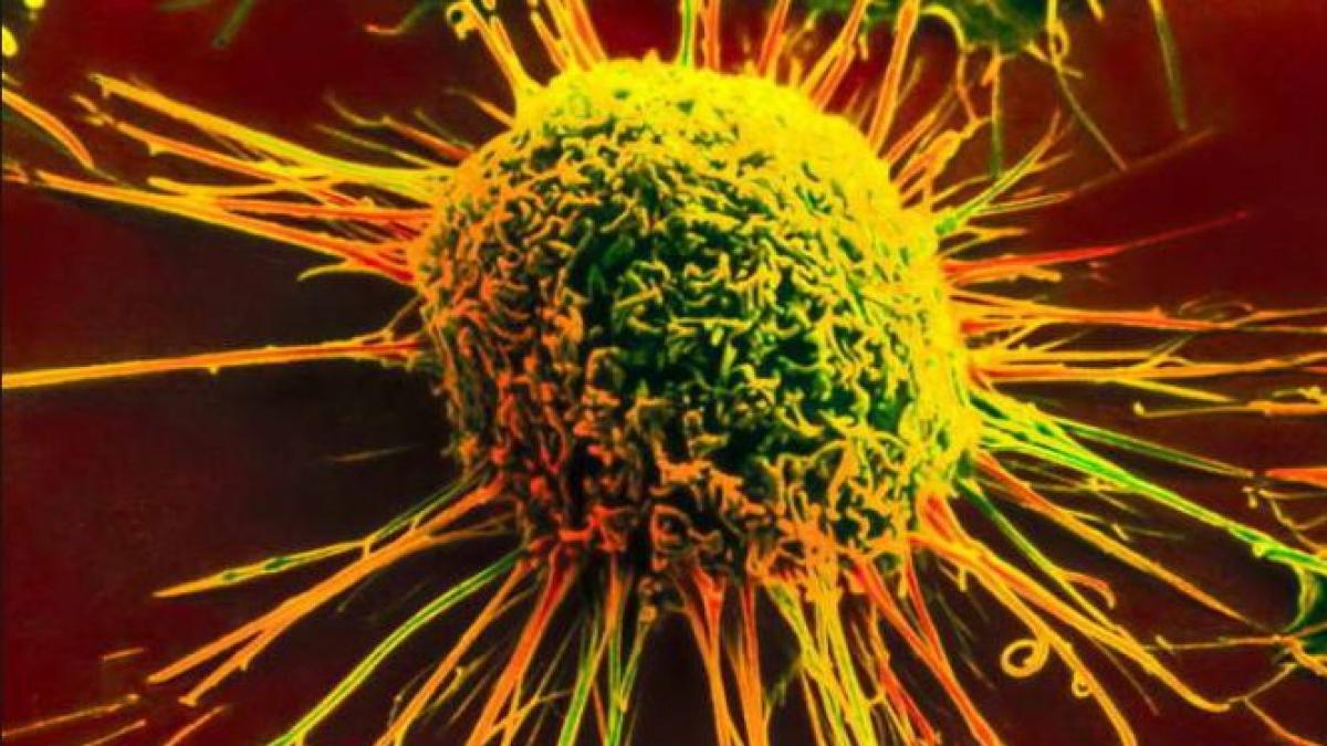 Povara uriaşă de pe umerii Uniunii Europene. La cât se ridică cheltuielile legate de CANCER la nivel european