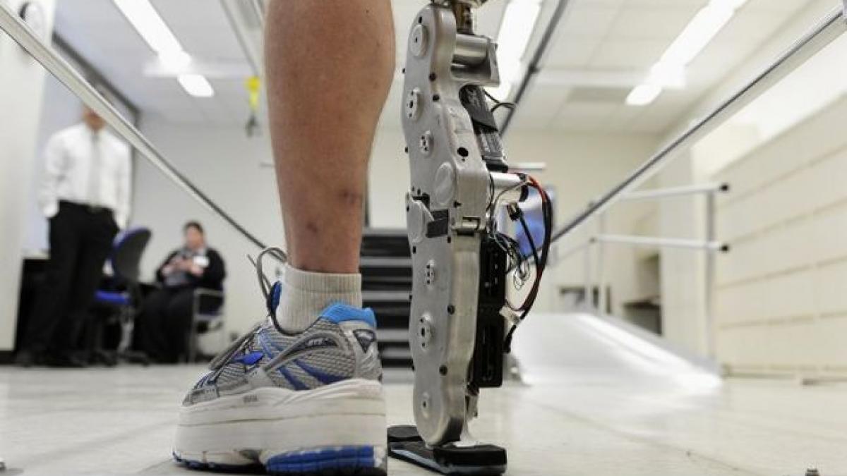 Premieră medicală. Primul picior bionic este complet funcţional