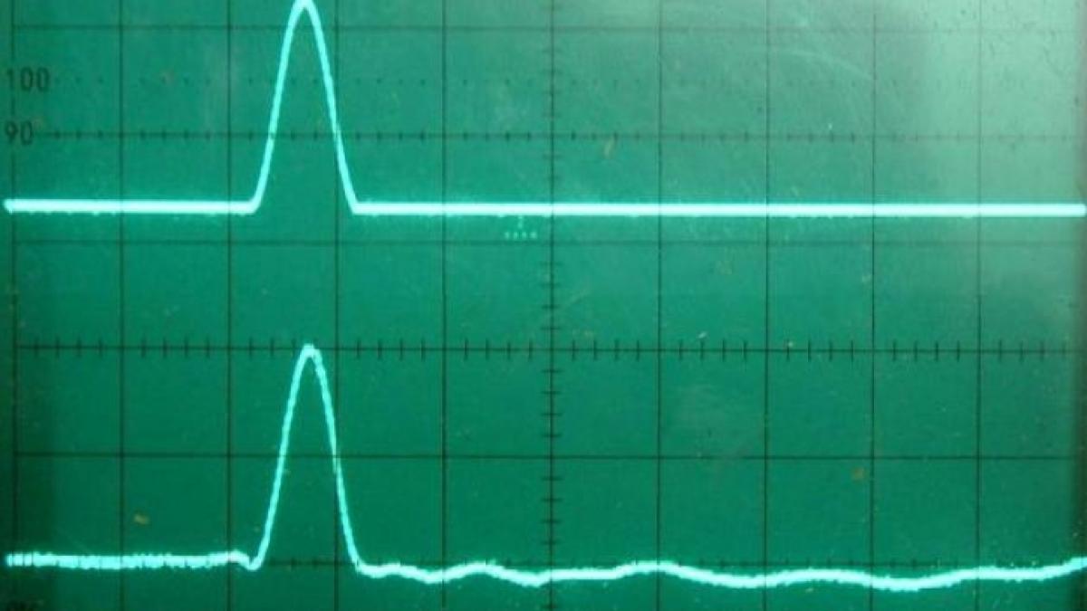 Sistemul Sanitar din România, în MOARTE CLINICĂ. Ne aflăm pe locul 33 din 35, în topul Uniunii Europene