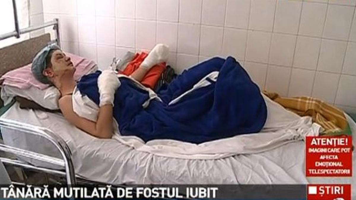 ŞOCANT! O tânără a fost violată şi desfigurată de fostul ei iubit