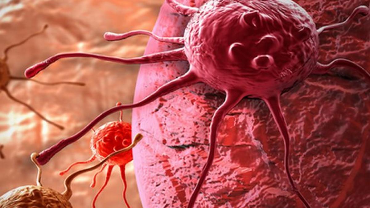 Organizaţia Mondială a Sănătăţii: Un &quot;tsunami&quot; de CANCER va lovi populaţia globului în viitorul apropiat