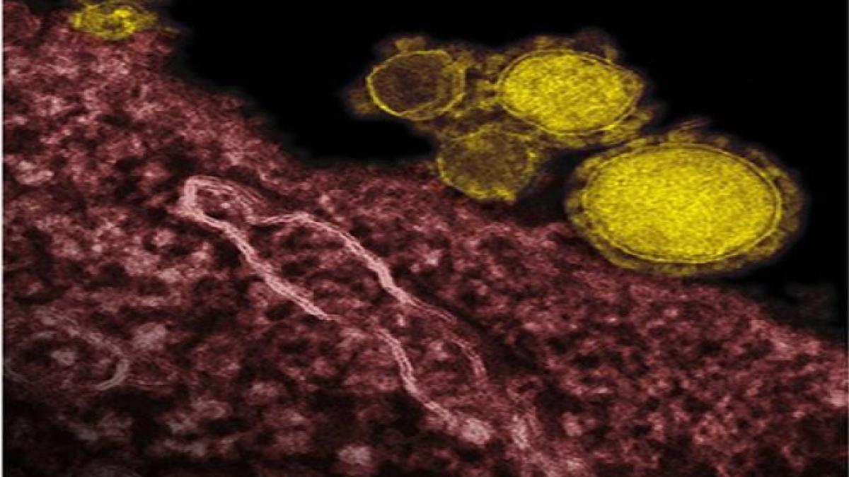 MERS se EXTINDE rapid în Orientul Mijlociu. Autorităţile sunt acuzate că au scăpat de sub control EPIDEMIA MORTALĂ