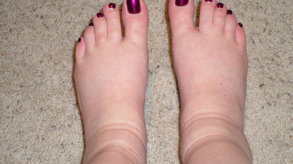 week-38-swollen-feet.jpg