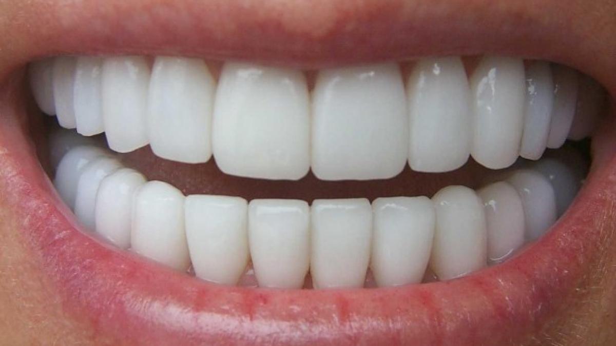 white teeth.jpg