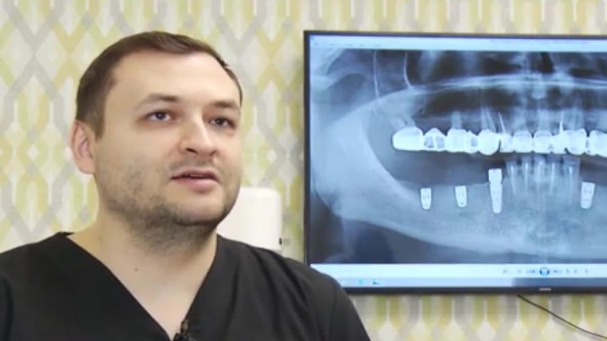 Numai de bine. Adevărat sau fals despre implantul dentar