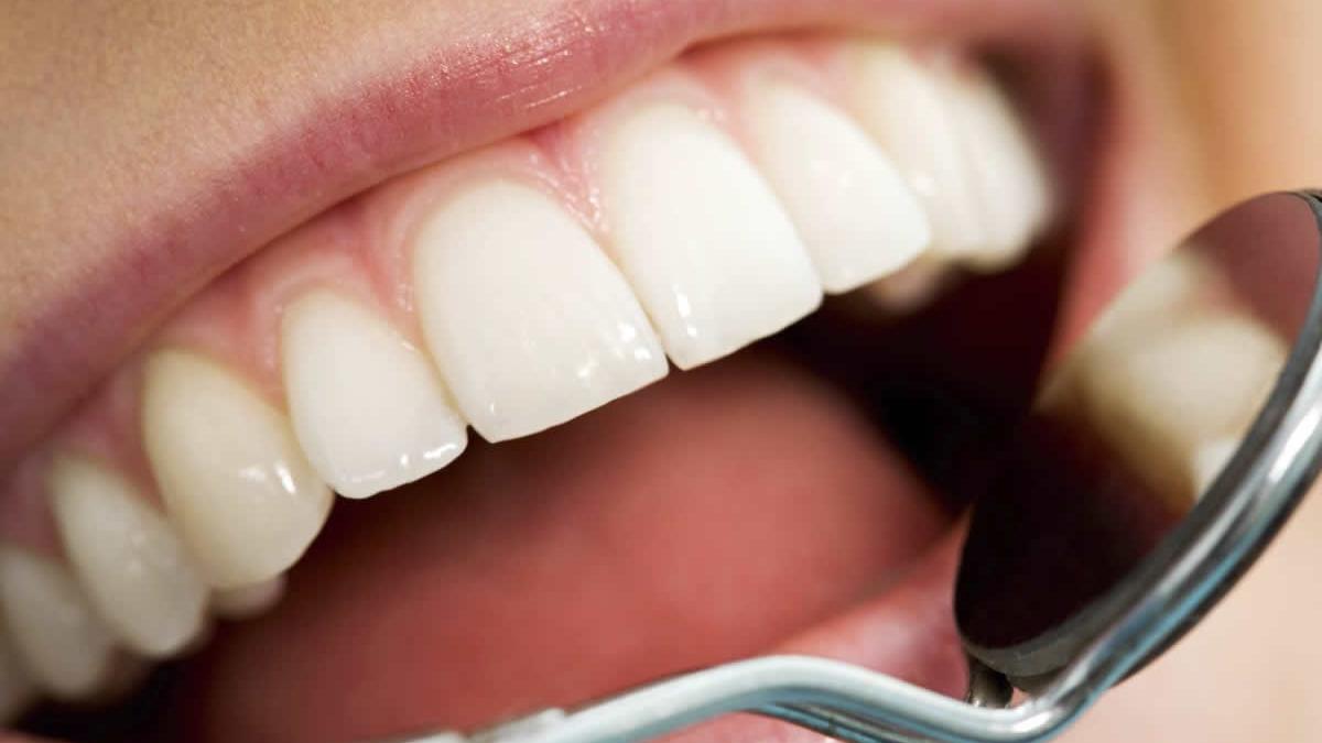 Românii ar putea da bani mai puţini pe dentist. CNAS vrea să dubleze plafonul de decontare a serviciilor stomatologice