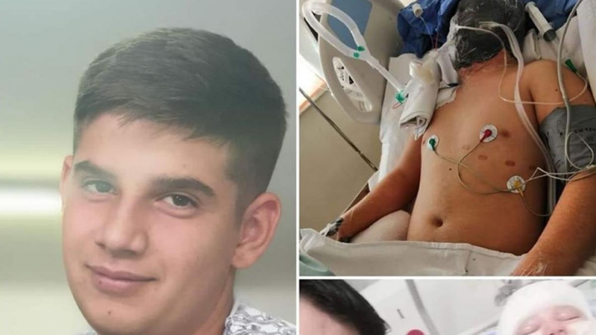 La 17 ani, Robert muncea pentru a-și ajuta familia numeroasă. După ore, adolescentul se ducea la un service auto pentru a munci. Într-o zi, la locul de muncă a avut o explozie...