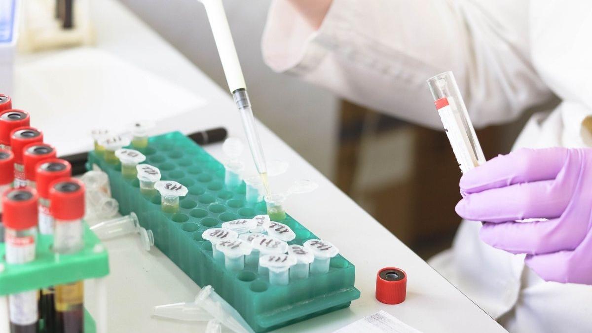 Primul test care poate stabili dacă o persoană a fost sau nu infectată cu coronavirus, aprobat în Statele Unite 