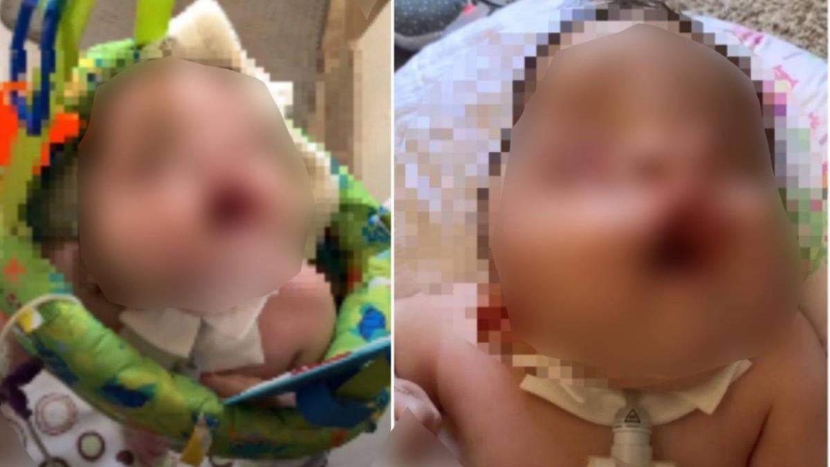 Mama unui copil cu probleme de dezvoltare ale creierului: "Mi-au spus să îmi ucid copilul, doar pentru că e diferit"