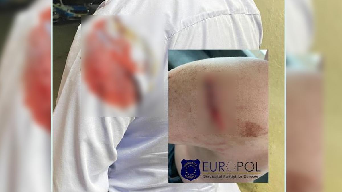 Sindicatul Europol, revoltat de decizia unui procuror: "Un polițist lovit cu sapa în zona capului în timpul unei intervenţii, considerat vinovat"