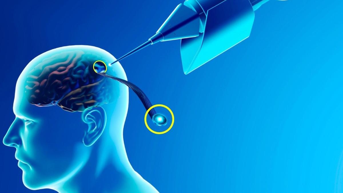 cip creier cerebral neuralink