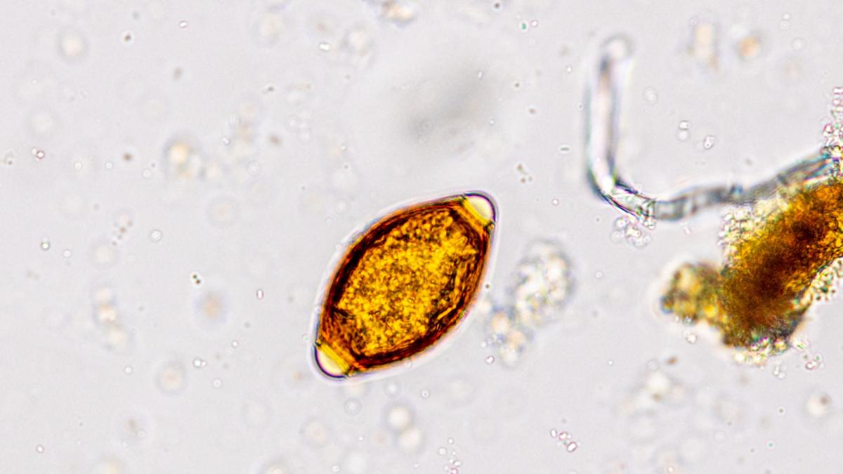 parazit trichuris