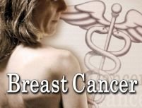 Tratament inovator pentru cancerul la sân