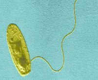 Legionella, un nou virus care îngrijorează Marea Britanie