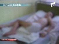 Italia. Un copil român a fost spitalizat cu vânătăi şi arsuri de ţigară