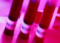 Bolnavii de hemofilie nu mai riscă infectarea cu HIV şi hepatita C