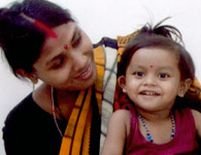 India. Fetiţa cu opt membre a zâmbit pentru prima dată după operaţie