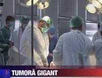 Medicii români au extirpat o tumoră cât un om <font color=red>(VIDEO)</font>