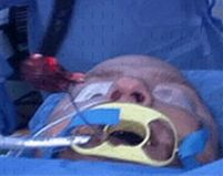 Eficient şi fără urme: Operaţia de apendicită se face acum şi prin gură