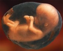 Noul Cod penal ar putea interzice avortul