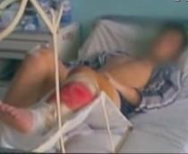 Un tânăr de 16 ani a rămas fără picior pentru că nu a fost operat la timp (VIDEO)