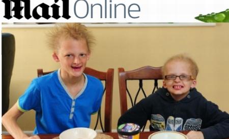 Doi copii britanici suferă de un sindrom care îi face să semene cu vampirii