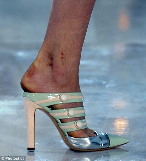 Imaginile opuse strălucirii de pe catwalk. Vezi cum arată picioarele modelelor după Săptămâna Modei