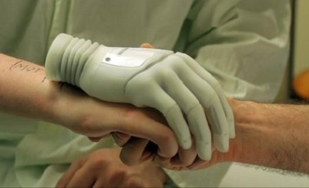 Un craiovean a inventat proteza medicală ce poate fi controlată prin Bluetooth