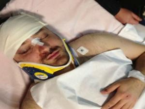 Andrei Ţârdea a fost bătut măr în faţa unui restaurant. Trei indivizi necunoscuţi l-au agresat în plină stradă