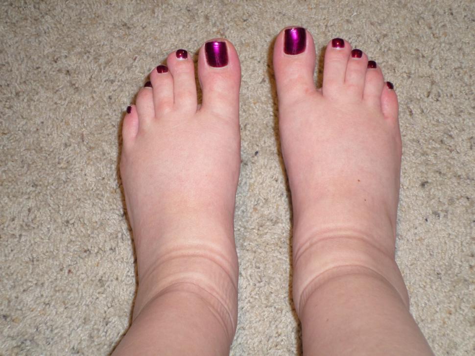 week-38-swollen-feet.jpg