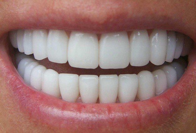 white teeth.jpg