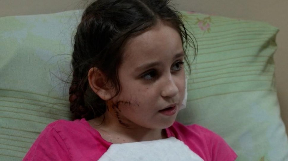 Fetiță de 11 ani împușcată în față de un soldat rus