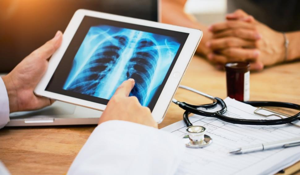 boala pulmonara cancer plamani doctor pacienti