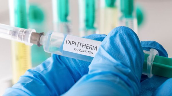 Două cazuri de difterie, confirmate în România. Boala extrem de contagioasă nu a mai fost întâlnită din 1990