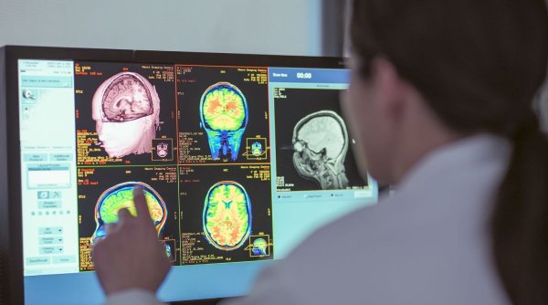 Schimbările de comportament ușor de recunoscut după un traumatism cranio-cerebral. Prof. Dr. Dafin Mureşanu: „Nu le dăm atenția cuvenită